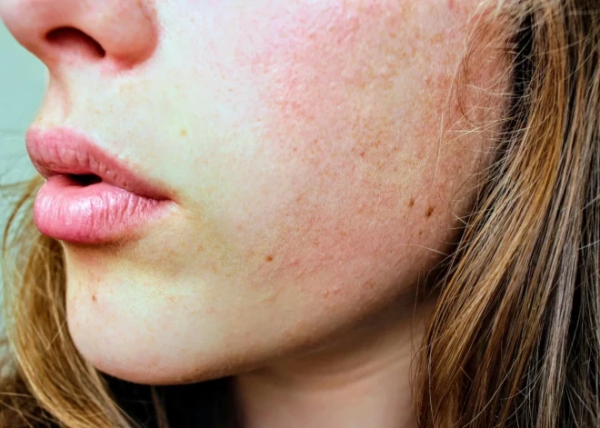 Купила за копейки - заплатила здоровьем: история опасной покупки на Temu