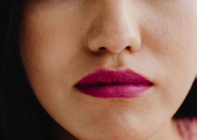 Ne tikai sausums un lobīšanās: simptomi uz lūpām, kas var liecināt par bīstamu diagnozi