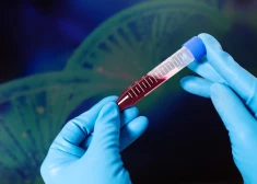 Stradiņa slimnīcā Hemofilijas dienā pievērsīs uzmanību asiņošanas traucējumu atpazīšanai