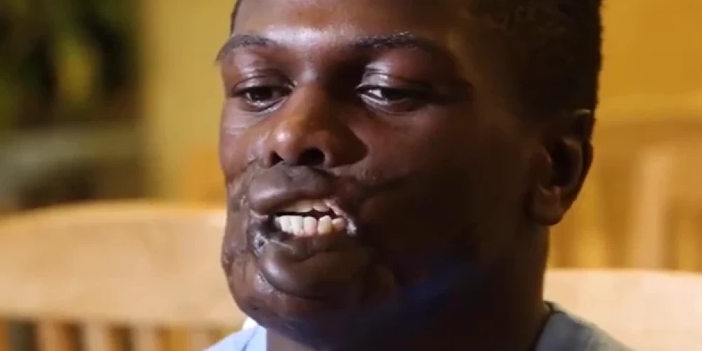 Viņš neļāva liktenim sevi salauzt: jaunietis pēc smaga uzbrukuma kļūst par čempionu.