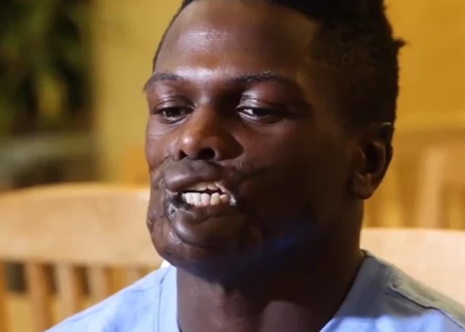 Bērnībā viņš izdzīvoja šimpanzu bara uzbrukumā, kurā zaudēja brālēnu — tagad viņš ir pusaudžu cīņas čempions