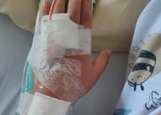 Šokējošs gadījums: māte domāja, ka dēlam ir smadzeņu audzējs, bet izrādījās, ka viņu saindēja ar D vitamīnu
