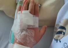 Шокирующий случай: мать думала, что у сына опухоль мозга, но оказалось - он отравлен витамином D