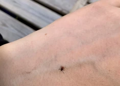 После снежной зимы в Латвии может стать больше клещей, чем обычно