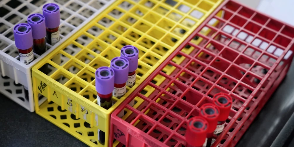 Латвия пока отстает, хотя мир уже меняет подход к переливанию крови.