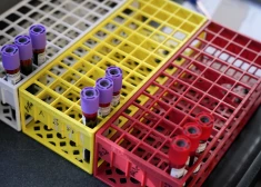 Пока мир меняет подходы, Латвия отстает: врачи предупреждают о проблеме с донорством крови