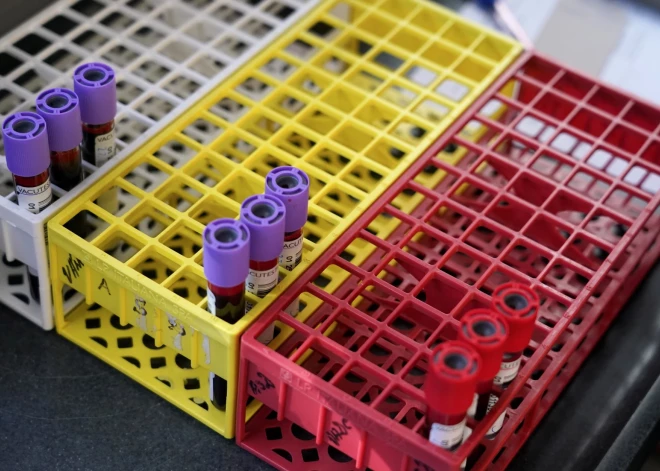 Пока мир меняет подходы, Латвия отстает: врачи предупреждают о проблеме с донорством крови