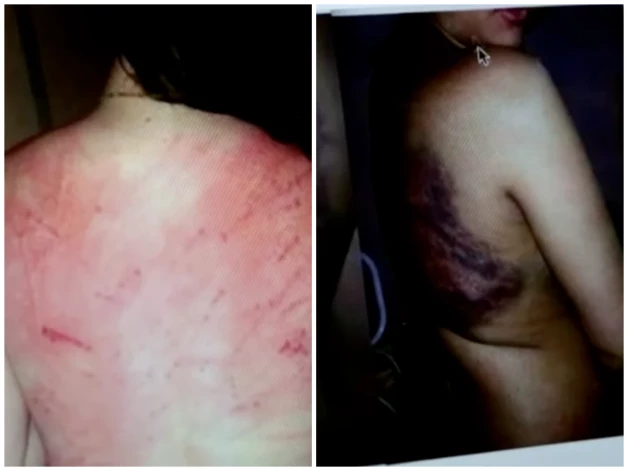 Sievietes atrāda pātagas atstātās asiņojošās brūces pēc tam, kad viņas tika pieķertas ballītē un sodītas ar miesassodu.