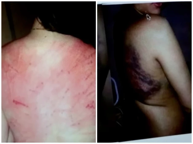 Женщины показывают кровоточащие раны от плети после того, как их поймали на вечеринке и наказали телесными повреждениями.