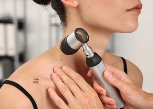 В Риге можно будет бесплатно проверить родинки и другие кожные образования без записи.