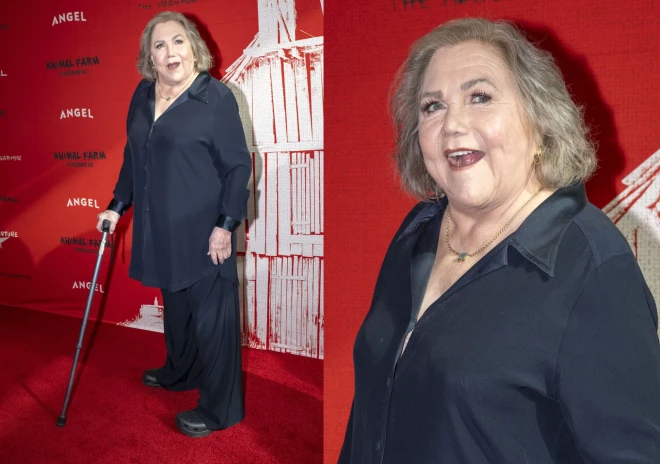 71-летняя актриса живёт с ревматоидным артритом уже с начала 90-х годов. 