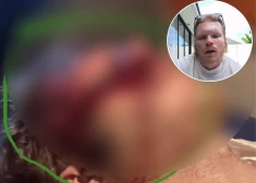 Smagā negadījumā Bali cietis latviešu fitnesa treneris Elvis Krūze.