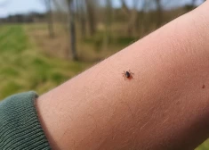 В одной латвийской больнице с пациентов уже сняли 12 клещей: специалисты предупредили - сезон может быть опасным