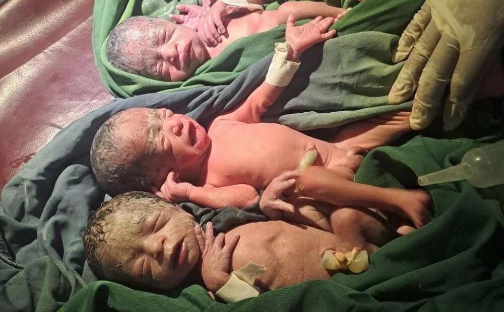 Pēc ilgstošām grūtībām ieņemt bērnu sieviete Etiopijā laidusi pasaulē piecīšus. FOTO