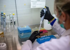 Slimības atklāšanai mediķi izmanto specifisku laboratorisko diagnostiku.