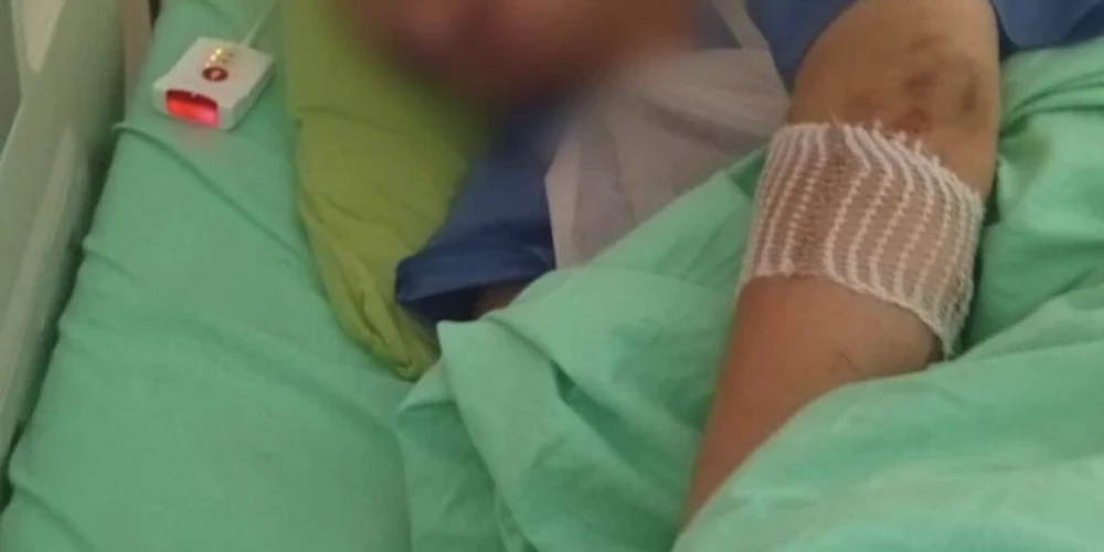 Negadījumā 25 gadus vecais Artjoms nopietni savainoja roku.