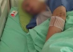 "Mums sastāstīja, ka līdz pusei roka samalta!" Jelgavas novadā gaļas mašīnā ierauta kāda vīrieša roka