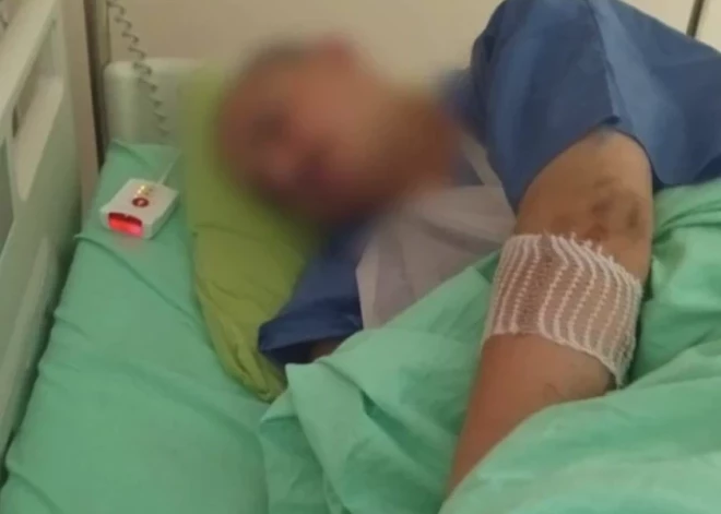 "Нам сказали, что ее перемололо до половины!" В Елгавском крае руку мужчины затянуло в мясорубку